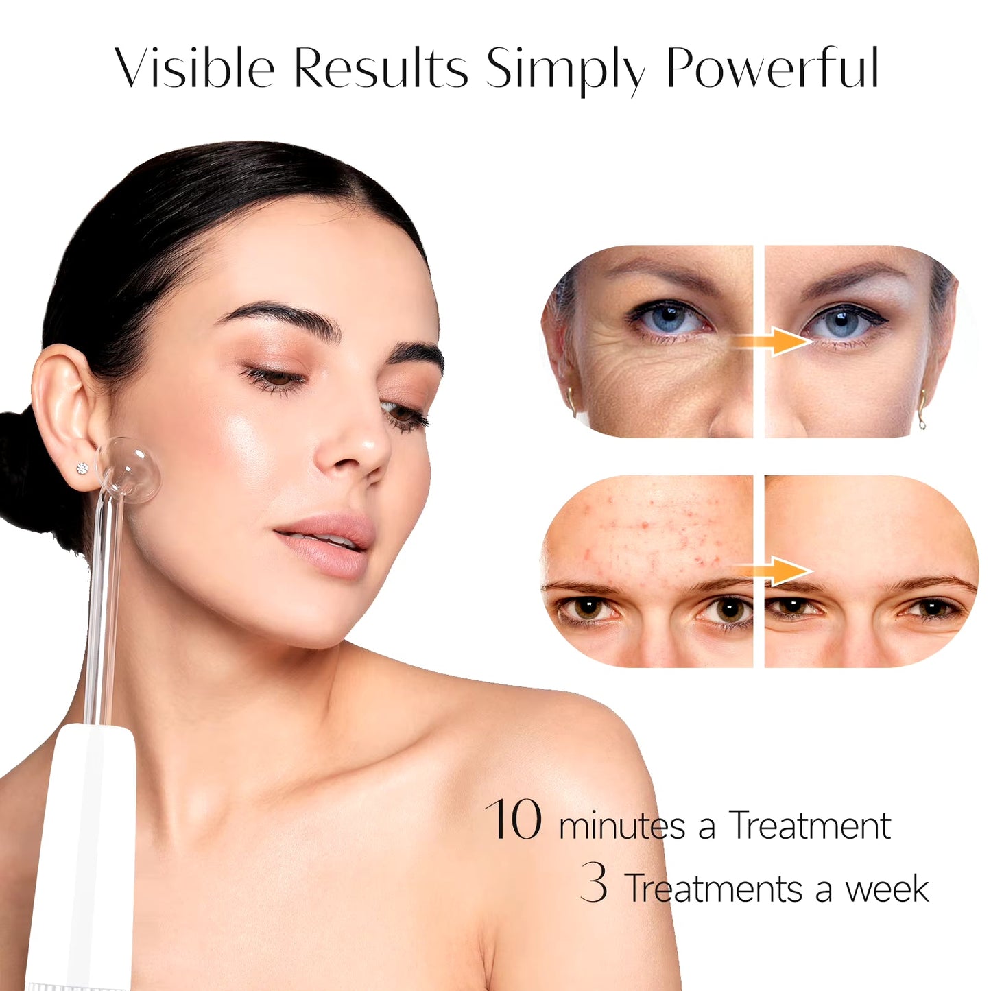 High Frequency Facial Machine Electrotherapy Wand Glass Neon + Argon Wands Remove Wrinkles High Frequency Facial