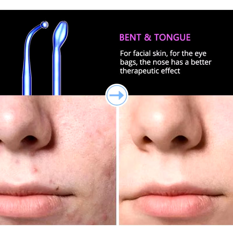 High Frequency Facial Machine Electrotherapy Wand Glass Neon + Argon Wands Remove Wrinkles High Frequency Facial